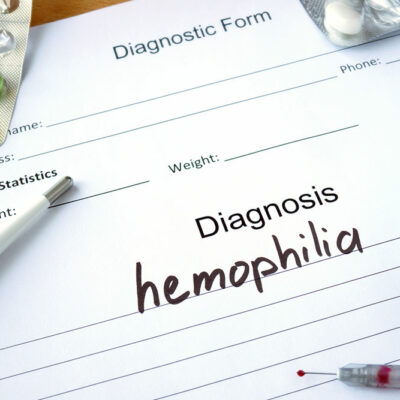 A guide to the treatments for hemophilia