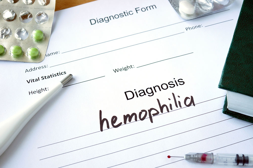 A guide to the treatments for hemophilia