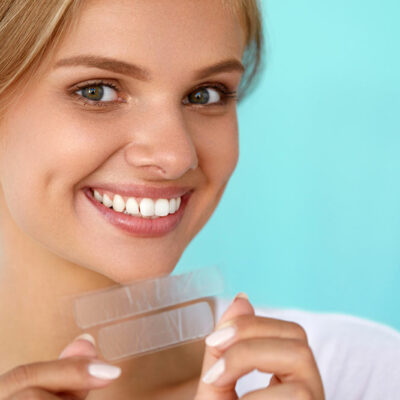 All you need to know about teeth whitening