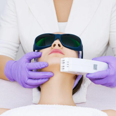 All you need to know about laser hair removal