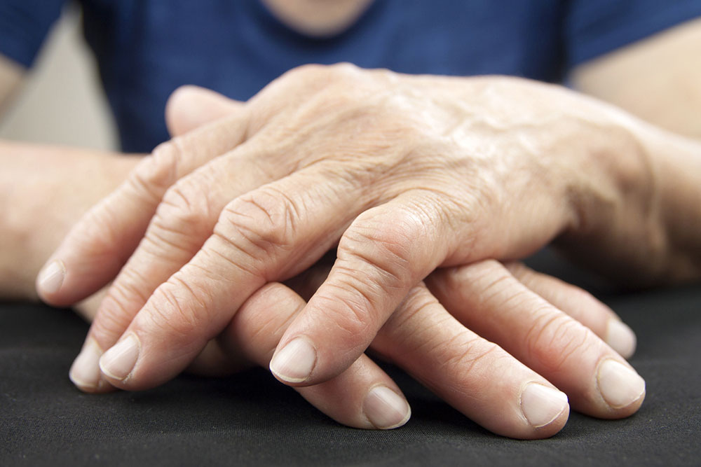 An overview of rheumatoid arthritis treatments