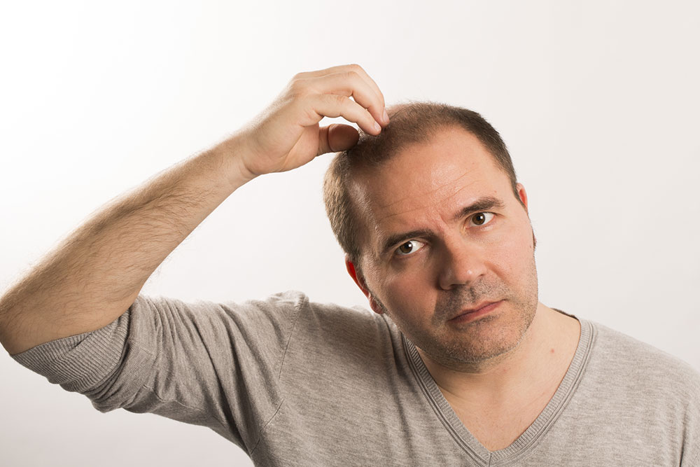 Best products in the market to control male pattern baldness