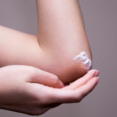 Eczema vs. atopic dermatitis–What you need to know