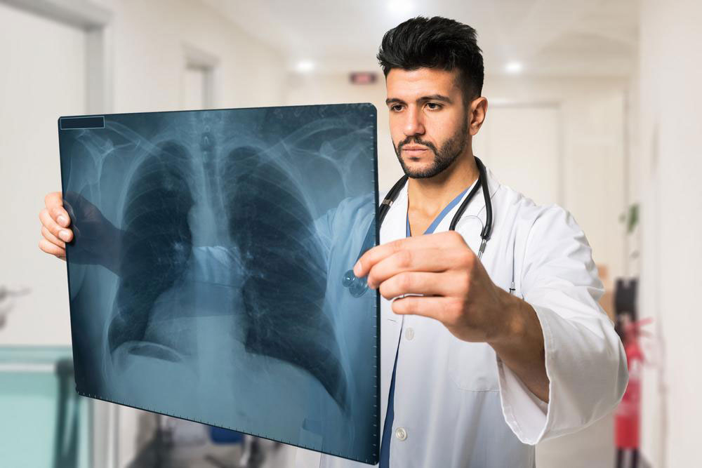 Lung cancer and its treatments