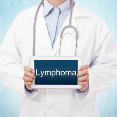Lymphoma – An overview