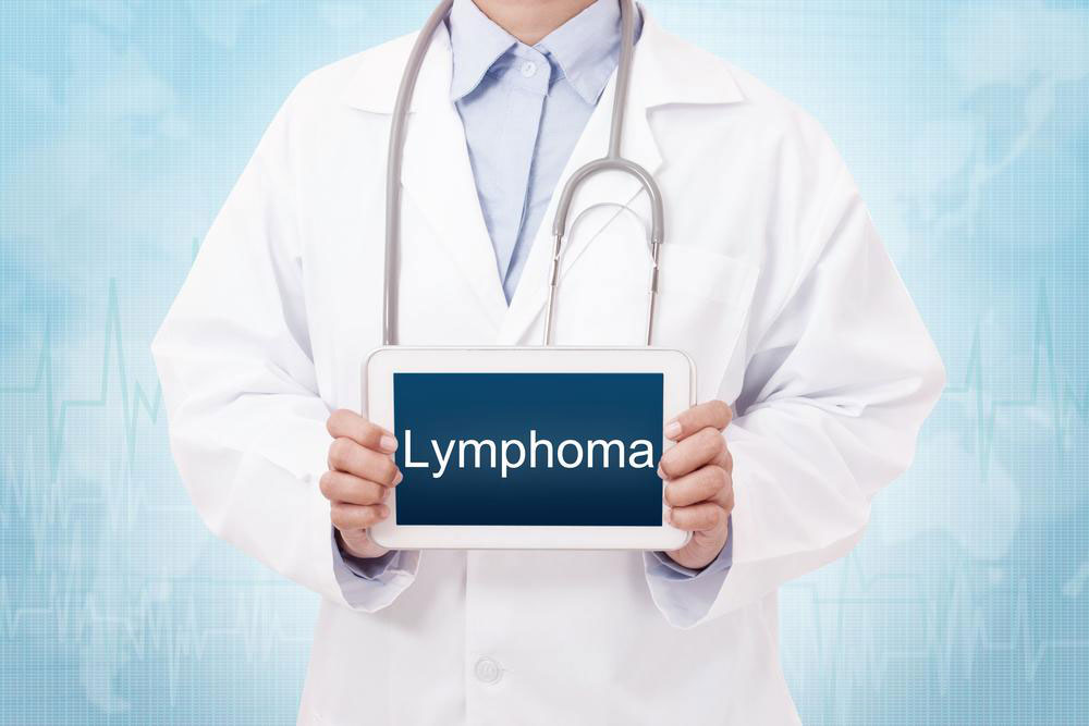 Lymphoma – An overview
