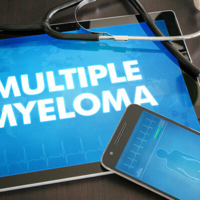 Multiple myeloma and its natural treatments