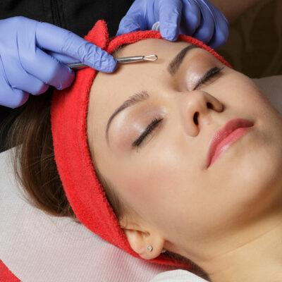 Top treatment options for acne in adults