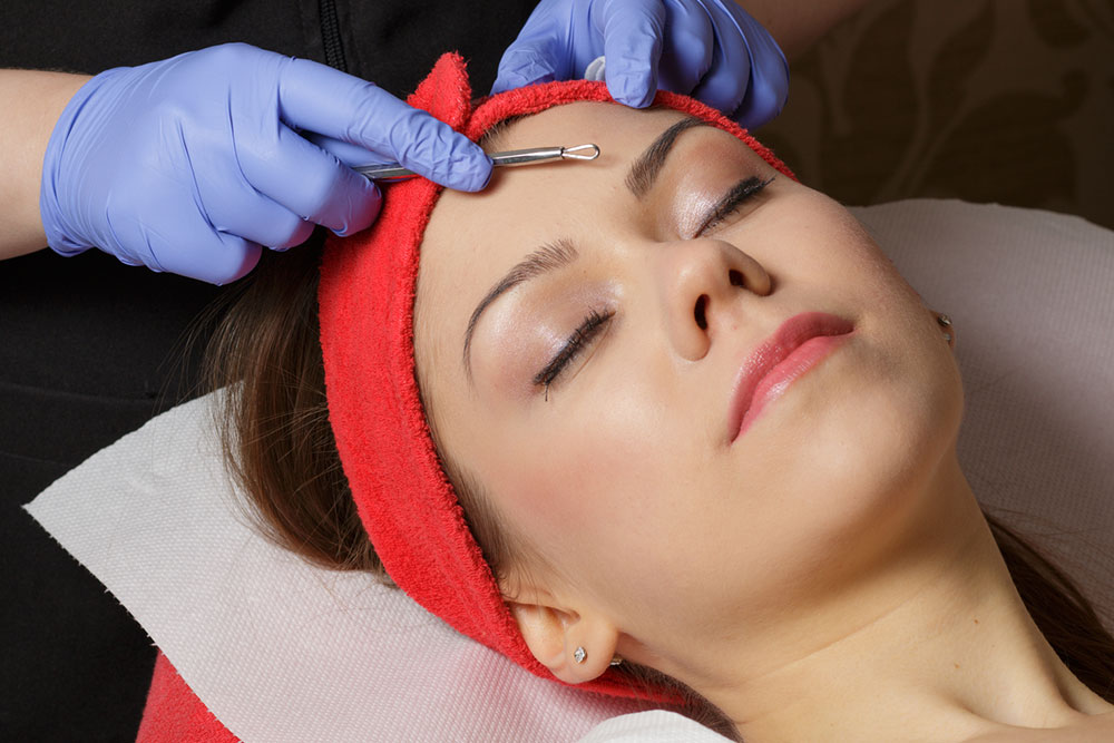 Top treatment options for acne in adults