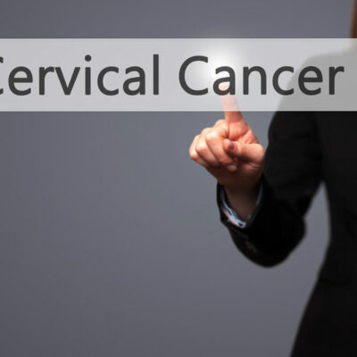 Top treatment options for cervical cancer