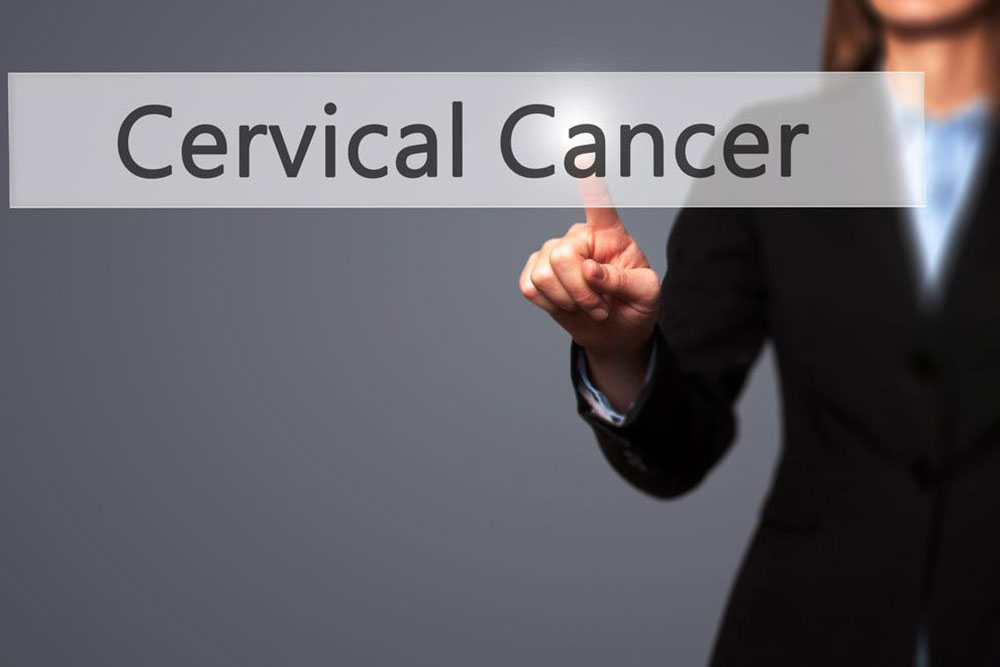 Top treatment options for cervical cancer
