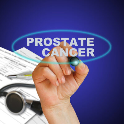 4 Early Symptoms of Prostate Cancer